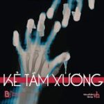 Kẻ Tầm Xương